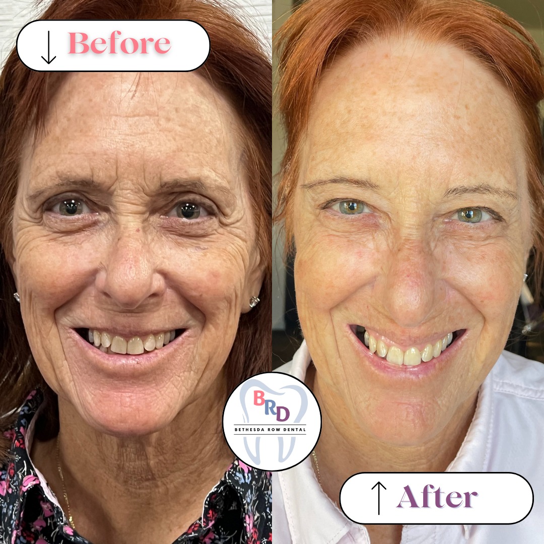 Bethesda Row Dental | Arestin  , TMJ Pain and 3Shape TRIOS Scanner