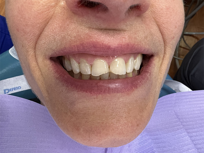 Bethesda Row Dental | Cosmetic Dentistry, Our Technology and Dental Emergencies