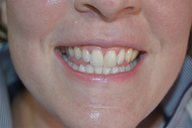 Bethesda Row Dental | Preventative Dentistry, Cosmetic Dentistry and Our Technology