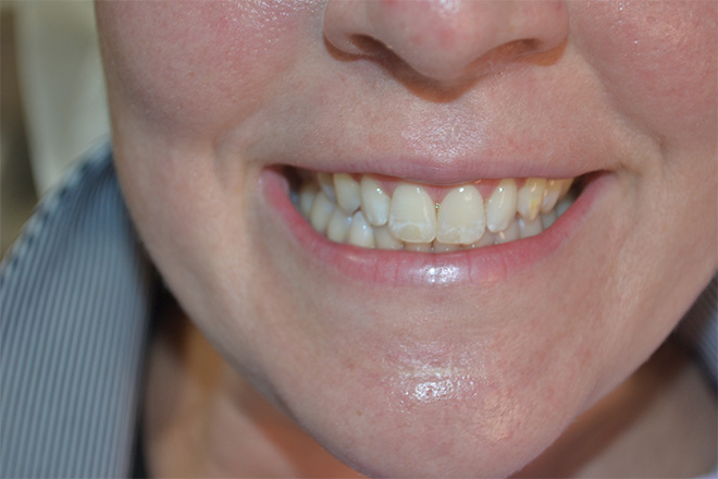 Bethesda Row Dental | Dental Emergencies, Sleep Apnea and Cosmetic Dentistry