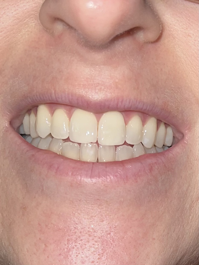 Bethesda Row Dental | Preventative Dentistry, Cosmetic Dentistry and Our Technology