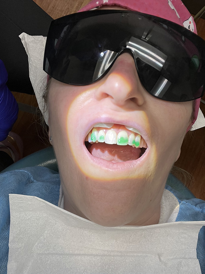 Bethesda Row Dental | Dental Emergencies, Sleep Apnea and Cosmetic Dentistry