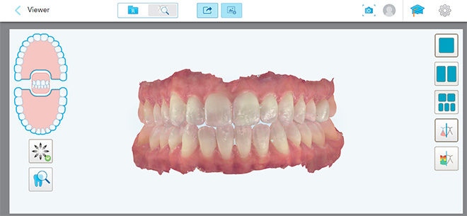 Bethesda Row Dental | Preventative Dentistry, Cosmetic Dentistry and Our Technology