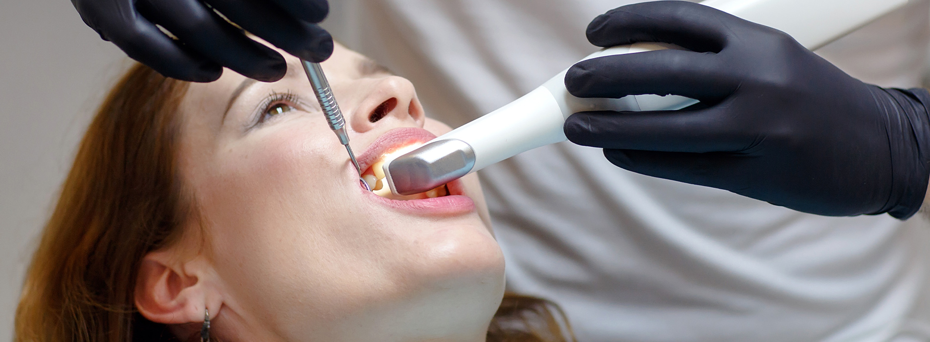 Bethesda Row Dental | Restorative Dentistry, Cosmetic Dentistry and Invisalign reg 