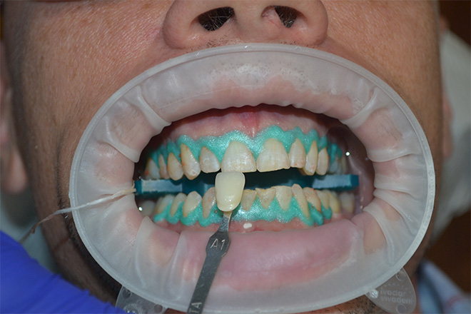 Bethesda Row Dental | Preventative Dentistry, Cosmetic Dentistry and Our Technology