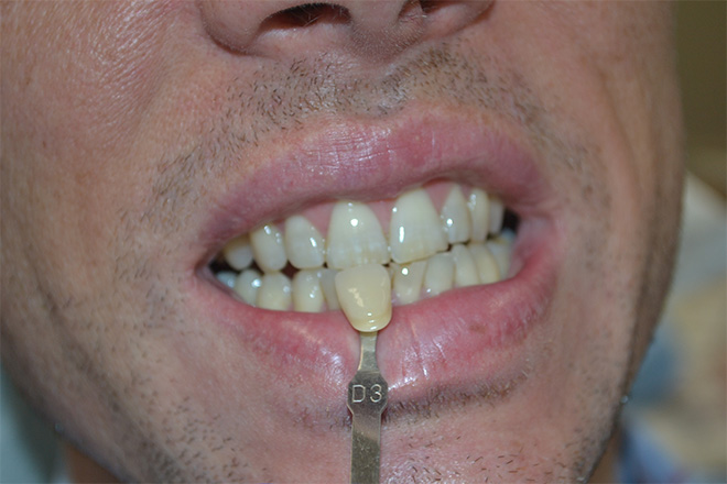 Bethesda Row Dental | Dental Emergencies, Sleep Apnea and Cosmetic Dentistry