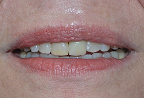 Bethesda Row Dental | Preventative Dentistry, Cosmetic Dentistry and Our Technology