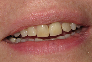 Bethesda Row Dental | Dental Emergencies, Sleep Apnea and Cosmetic Dentistry