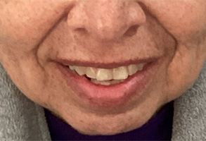 Bethesda Row Dental | Implant Dentistry, Teeth Whitening and Invisalign®