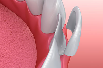 Bethesda Row Dental | Sleep Apnea, Cosmetic Dentistry and Preventative Dentistry