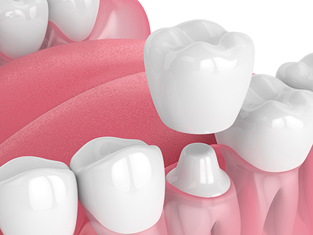 Bethesda Row Dental